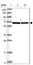 Phosphoglucomutase 3 antibody, HPA029759, Atlas Antibodies, Western Blot image 