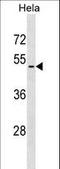 Vasoactive Intestinal Peptide Receptor 2 antibody, LS-C160530, Lifespan Biosciences, Western Blot image 