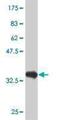 Pancreas Associated Transcription Factor 1a antibody, H00256297-M03, Novus Biologicals, Western Blot image 