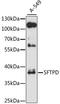 Surfactant Protein D antibody, LS-C746785, Lifespan Biosciences, Western Blot image 