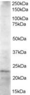 Ubiquitin Conjugating Enzyme E2 K antibody, EB05750, Everest Biotech, Western Blot image 