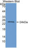 Fibroblast Growth Factor 21 antibody, LS-C314939, Lifespan Biosciences, Western Blot image 