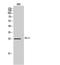 Epstein-Barr Virus Induced 3 antibody, STJ97340, St John