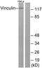 Vinculin antibody, A30448, Boster Biological Technology, Western Blot image 