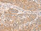 Ribosomal Protein S6 Kinase A1 antibody, CSB-PA121989, Cusabio, Immunohistochemistry paraffin image 