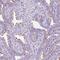 Transmembrane Protein 89 antibody, PA5-62811, Invitrogen Antibodies, Immunohistochemistry paraffin image 