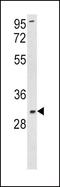 Superoxide Dismutase 3 antibody, GTX81678, GeneTex, Western Blot image 