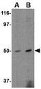 Fasciculation And Elongation Protein Zeta 2 antibody, GTX85423, GeneTex, Western Blot image 