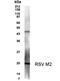 Respiratory Syncytial Virus M2 Protein antibody, NB100-93589, Novus Biologicals, Western Blot image 