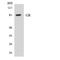 Nuclear Receptor Subfamily 3 Group C Member 1 antibody, LS-B14669, Lifespan Biosciences, Western Blot image 