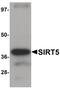 Sirtuin 5 antibody, PA5-20966, Invitrogen Antibodies, Western Blot image 