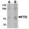FTO Alpha-Ketoglutarate Dependent Dioxygenase antibody, MBS150814, MyBioSource, Western Blot image 