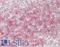 MCL1 Apoptosis Regulator, BCL2 Family Member antibody, LS-B13959, Lifespan Biosciences, Immunohistochemistry paraffin image 