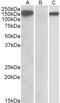 Aldehyde dehydrogenase, mitochondrial antibody, 42-610, ProSci, Enzyme Linked Immunosorbent Assay image 