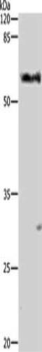 Aldehyde Dehydrogenase 1 Family Member A1 antibody, CSB-PA286031, Cusabio, Western Blot image 