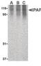 NLR family CARD domain-containing protein 4 antibody, PA5-20014, Invitrogen Antibodies, Western Blot image 