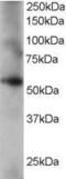 Coronin 1C antibody, PA5-18276, Invitrogen Antibodies, Western Blot image 