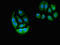 Engulfment And Cell Motility 2 antibody, LS-C677804, Lifespan Biosciences, Immunofluorescence image 