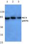 Protein Kinase C Theta antibody, AP20801PU-N, Origene, Western Blot image 