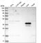 Arginase 1 antibody, HPA024006, Atlas Antibodies, Western Blot image 