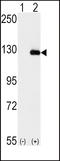 BUB1 Mitotic Checkpoint Serine/Threonine Kinase B antibody, LS-C101149, Lifespan Biosciences, Western Blot image 
