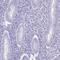 Spermatogenesis-associated protein 4 antibody, PA5-53959, Invitrogen Antibodies, Immunohistochemistry paraffin image 
