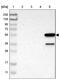 Lymphocyte Antigen 6 Family Member G6F antibody, NBP1-86749, Novus Biologicals, Western Blot image 