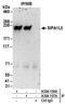 Signal Induced Proliferation Associated 1 Like 3 antibody, A304-156A, Bethyl Labs, Immunoprecipitation image 