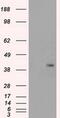 Protein Phosphatase 1 Regulatory Subunit 7 antibody, MA5-24968, Invitrogen Antibodies, Western Blot image 