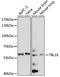 Transducin Beta Like 1 X-Linked antibody, LS-C750073, Lifespan Biosciences, Western Blot image 