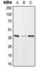 Mitochondrial Transcription Termination Factor 1 antibody, LS-C353023, Lifespan Biosciences, Western Blot image 
