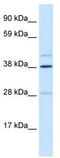 Ceramide Synthase 3 antibody, TA329371, Origene, Western Blot image 