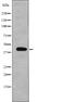 Eukaryotic Translation Initiation Factor 2B Subunit Beta antibody, PA5-64822, Invitrogen Antibodies, Western Blot image 
