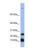 Hepcidin Antimicrobial Peptide antibody, NBP1-59337, Novus Biologicals, Western Blot image 