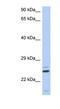 Tetratricopeptide Repeat Domain 9C antibody, NBP1-55306, Novus Biologicals, Western Blot image 