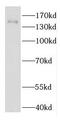 Erythroid Differentiation Regulatory Factor 1 antibody, FNab02638, FineTest, Western Blot image 