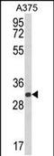 Deoxyribose-Phosphate Aldolase antibody, PA5-49637, Invitrogen Antibodies, Western Blot image 