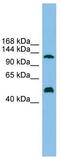 Phosphoribosylglycinamide Formyltransferase, Phosphoribosylglycinamide Synthetase, Phosphoribosylaminoimidazole Synthetase antibody, TA338360, Origene, Western Blot image 