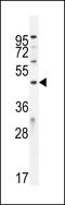 Phosphoinositide-binding protein PIP3-E antibody, LS-C165108, Lifespan Biosciences, Western Blot image 