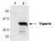 Radical S-Adenosyl Methionine Domain Containing 2 antibody, LS-C343717, Lifespan Biosciences, Western Blot image 