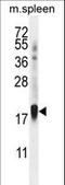 Zinc Finger Protein 593 antibody, LS-C160913, Lifespan Biosciences, Western Blot image 