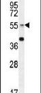 Beta-1,3-galactosyl-O-glycosyl-glycoprotein beta-1,6-N-acetylglucosaminyltransferase 3 antibody, PA5-24455, Invitrogen Antibodies, Western Blot image 