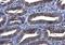 Spleen Associated Tyrosine Kinase antibody, NBP1-32945, Novus Biologicals, Immunohistochemistry paraffin image 