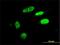HIC ZBTB Transcriptional Repressor 1 antibody, H00003090-M02, Novus Biologicals, Immunofluorescence image 