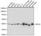 Pyruvate Dehydrogenase E1 Alpha 1 Subunit antibody, 16-941, ProSci, Western Blot image 