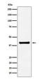 Aldolase, Fructose-Bisphosphate A antibody, M05022, Boster Biological Technology, Western Blot image 