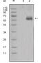 Dickkopf WNT Signaling Pathway Inhibitor 1 antibody, MA5-15497, Invitrogen Antibodies, Western Blot image 