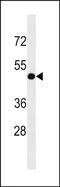 Integrator complex subunit 4-like protein 1 antibody, PA5-49111, Invitrogen Antibodies, Western Blot image 