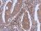 Dynamin 2 antibody, PA5-29017, Invitrogen Antibodies, Immunohistochemistry paraffin image 