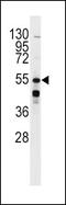 Adrenoceptor Beta 2 antibody, PA5-14117, Invitrogen Antibodies, Western Blot image 